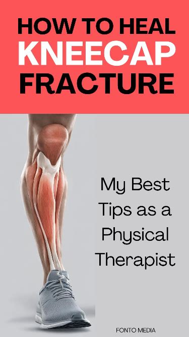 bronze kneecap|broken knee cap recovery time.